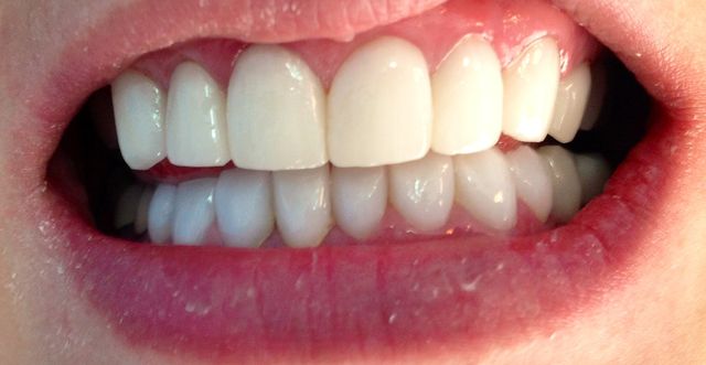 Sonrisa completa